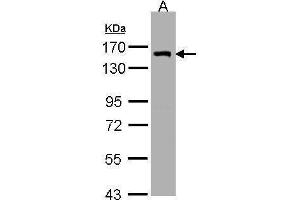 WB Image Sample (30μg whole cell lysate) A:H1299 7. (LIMCH1 Antikörper  (C-Term))