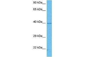 Host:  Mouse  Target Name:  PCBP1  Sample Tissue:  Mouse Brain  Antibody Dilution:  1ug/ml (PCBP1 Antikörper  (Middle Region))