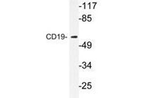 Western blot analysis of CD19 antibody in extracts from COS7 cells. (CD19 Antikörper)