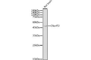 Western blot analysis of extracts of Rat brain, using C9orf72 antibody (ABIN7266391) at 1:1000 dilution.