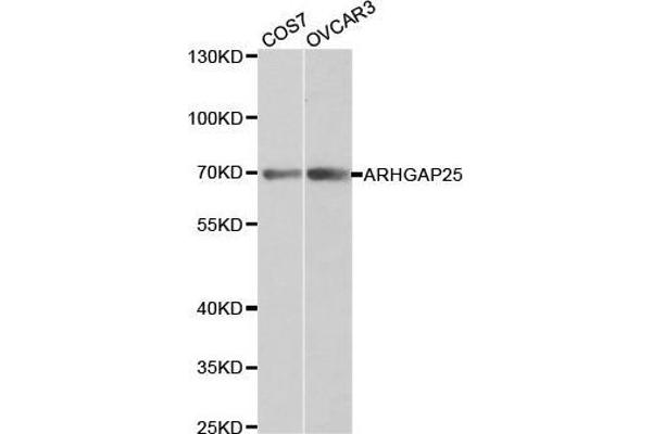 ARHGAP25 Antikörper  (AA 1-370)