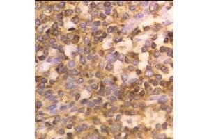 HLA Class 1 staining (ABIN118900) on Human tonsil. (HLA-ABC Antikörper)