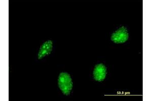 Immunofluorescence of monoclonal antibody to HIC1 on HeLa cell. (HIC1 Antikörper  (AA 396-453))