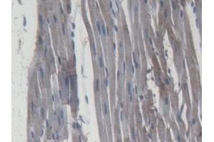 Detection of MMP9 in Rat Cardiac Muscle Tissue using Monoclonal Antibody to Matrix Metalloproteinase 9 (MMP9) (MMP 9 Antikörper  (AA 226-391))