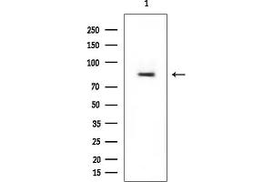 Western blot analysis of lysates from Rat brain, using MSP/MST1 Mouse Monoclonal Antibody at 1/1000 dilution.