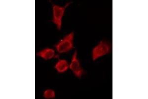 ABIN6276159 staining HeLa by IF/ICC. (OR4P4 Antikörper  (Internal Region))