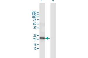 Western Blot analysis of DCAKD expression in transfected 293T cell line by DCAKD MaxPab polyclonal antibody.