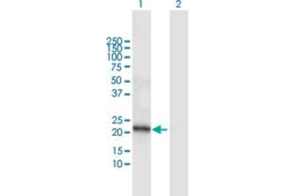 DCAKD anticorps  (AA 1-231)