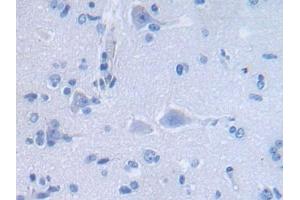 Detection of DEFa3 in Human Cerebrum Tissue using Polyclonal Antibody to Defensin Alpha 3, Neutrophil Specific (DEFa3) (DEFa3 Antikörper  (AA 21-94))