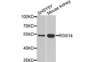 Western blot analysis of extracts of various cells, using RGS14 antibody.