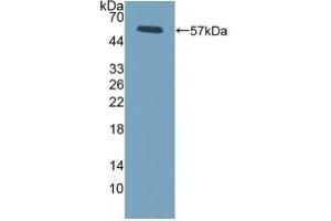 Detection of Recombinant FcgR3A, Mouse using Polyclonal Antibody to Fc Fragment Of IgG Low Affinity IIIa Receptor (FcgR3A) (FCGR3A Antikörper  (AA 5-240))