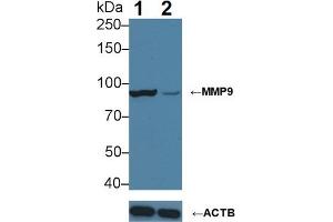 Knockout Varification: Lane 1: Wild-type HepG2 cell lysate; Lane 2: MMP9 knockout HepG2 cell lysate; Predicted MW: 76kDa Observed MW: 90kDa Primary Ab: 3µg/ml Mouse Anti-Human MMP9 Antibody Second Ab: 0. (MMP 9 Antikörper  (AA 213-399))