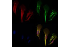 ABIN6257932 and ABIN6275132 staining Hela cells by IF/ICC.