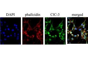 Expression of  in human D54 glioma cells. (CLCN3 Antikörper  (Intracellular))