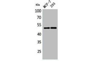 Western Blot analysis of MCF-7, 293 cells using PD-ECGF Polyclonal Antibody. (Thymidine Phosphorylase Antikörper  (N-Term))
