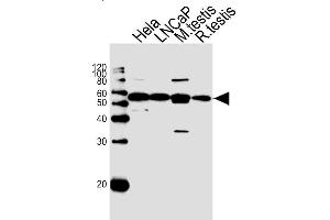 Lane 1: HeLa Cell lysates, Lane 2: LNCaP Cell lysates, Lane 3: Mouse testis lysates, Lane 4: Rat testis lysates, probed with ULK3 (1404CT148. (ULK3 Antikörper)