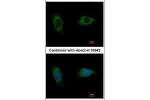 ICC/IF Image Immunofluorescence analysis of methanol-fixed HeLa, using EVC2, antibody at 1:500 dilution. (EVC2 Antikörper  (C-Term))