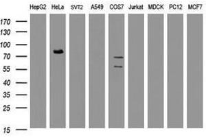 Image no. 2 for anti-HBS1-Like (HBS1L) (AA 1-242) antibody (ABIN1490627) (HBS1L Antikörper  (AA 1-242))
