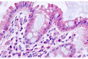 ABIN768623 (5µg/ml) staining of paraffin embedded Human Small Intestine. (TGFBR1 Antikörper  (AA 50-63))
