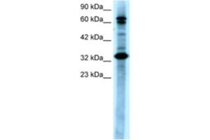 Western Blotting (WB) image for anti-TGF-beta Activated Kinase 1/MAP3K7 Binding Protein 2 (TAB2) antibody (ABIN2460457) (TAB2 Antikörper)