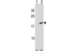 Western Blotting (WB) image for anti-ADP-Ribosylation Factor-Like 2 (ARL2) antibody (ABIN2998892) (ARL2 Antikörper)