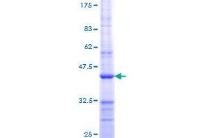 Retinoblastoma 1 Protein (RB1) (AA 371-470) (GST tag)
