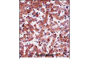 BP Antibody (N-term) (ABIN657686 and ABIN2846678) immunohistochemistry analysis in formalin fixed and paraffin embedded human liver tissue followed by peroxidase conjugation of the secondary antibody and DAB staining. (AMBP Antikörper  (N-Term))