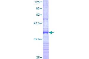 ADAMTS13 Protein (AA 1328-1427) (GST tag)