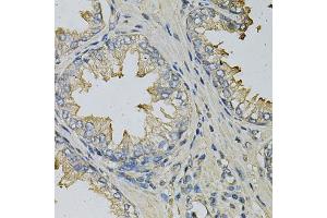 Immunohistochemistry of paraffin-embedded human prostate using LITAF Antibody (ABIN6130523, ABIN6143254, ABIN6143255 and ABIN6221131) at dilution of 1:100 (40x lens). (LITAF Antikörper  (AA 1-161))