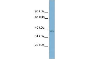 WB Suggested Anti-NUBP1 Antibody Titration: 0. (NUBP1 Antikörper  (Middle Region))
