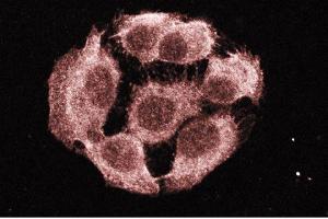 Immunofluorescence staining of A431 cells (Human epithelial carcinoma, ATCC CRL-1555). (PTPN11 Antikörper  (AA 1-177))