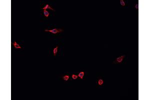 ABIN6268937 staining U-2 OS cells by IF/ICC. (MEF2C Antikörper  (C-Term))