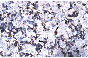 Human Liver (FOXP3 Antikörper  (N-Term))