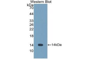 Detection of Recombinant CST1, Human using Polyclonal Antibody to Cystatin 1 (CST1)