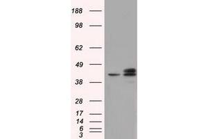 Image no. 2 for anti-Nucleoredoxin-Like 2 (NXNL2) antibody (ABIN1499887) (NXNL2 Antikörper)