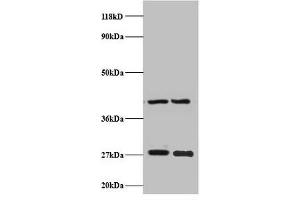 Western blot All lanes: NDUFV2 antibody at 2 μg/mL Lane 1: EC109 whole cell lysate Lane 2: 293T whole cell lysate Secondary Goat polyclonal to rabbit IgG at 1/15000 dilution Predicted band size: 28 kDa Observed band size: 28 kDa (NDUFV2 Antikörper  (AA 35-249))