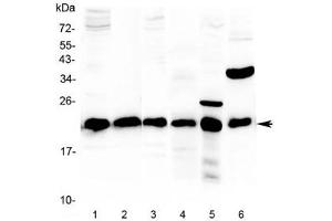 Western blot testing of 1) rat pancreas, 2) testis, 3) liver, 4) mouse pancreas, 5) mouse kidney and 6) mouse skeletal muscle lysate with DJ-1 antibody at 0. (PARK7/DJ1 Antikörper)