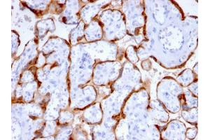 Formalin-fixed, paraffin-embedded human Placenta stained with PAPP-A Mouse Monoclonal Antibody (PAPPA/2715). (PAPPA Antikörper  (AA 351-523))
