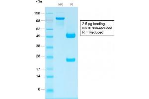 SDS-PAGE Analysis Purified IgG Rabbit Recombinant Monoclonal Antibody (IG1707R). (Rekombinanter IGHG Antikörper)
