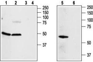 Western blot analysis of rat aortic endothelial cells (lanes 1, 3), rat brain (lanes 2, 4) and Jurkat (lanes 5, 6) lysates: - 1,2,5. (Adenosine A2a Receptor Antikörper  (3rd Intracellular Loop))