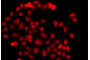 Immunofluorescence analysis of A549 cell using MLF1 antibody.