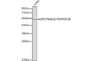 Western Blotting (WB) image for anti-Tumor Necrosis Factor Receptor Superfamily, Member 10b (TNFRSF10B) (AA 56-210) antibody (ABIN3021808)