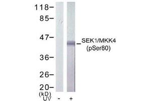 Image no. 2 for anti-Mitogen-Activated Protein Kinase Kinase 4 (MAP2K4) (pSer80) antibody (ABIN196911) (MAP2K4 Antikörper  (pSer80))