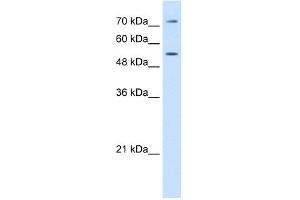 WB Suggested Anti-LBP Antibody Titration:  0. (LBP Antikörper  (C-Term))