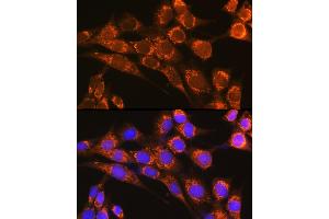 Immunofluorescence analysis of NIH-3T3 cells using CFP Rabbit pAb (ABIN6127651, ABIN6138467, ABIN6138468 and ABIN6221045) at dilution of 1:100 (40x lens). (CFP Antikörper  (AA 190-469))