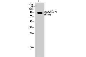 Western Blotting (WB) image for anti-X-Ray Repair Complementing Defective Repair in Chinese Hamster Cells 6 (XRCC6) (acLys331) antibody (ABIN3172846) (XRCC6 Antikörper  (acLys331))