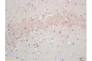Formalin-fixed and paraffin embedded rat brain labeled with Rabbit Anti Annexin A13 Polyclonal Antibody, Unconjugated (ABIN671181) at 1:200 followed by conjugation to the secondary antibody and DAB staining
