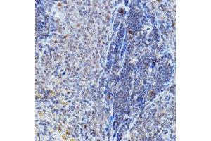 Immunohistochemistry of paraffin-embedded rat spleen using DGCR8 Rabbit pAb (ABIN7266761) at dilution of 1:200 (40x lens). (DGCR8 Antikörper)