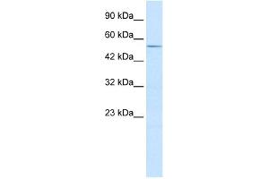 WB Suggested Anti-ZFP91 Antibody Titration:  2. (ZFP91 Antikörper  (Middle Region))