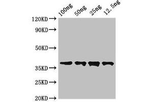 Western Blot Positive WB detected in Recombinant protein All lanes: DST antibody at 3. (Dystonin Antikörper  (AA 1-195))